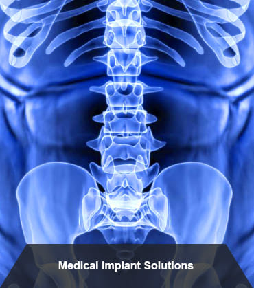 Medical Implant Solutions